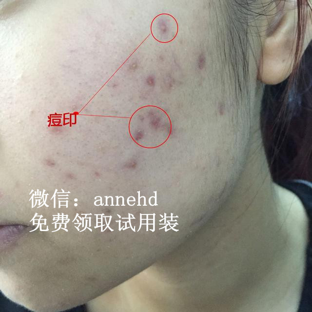 成都博爱坑人乱收费千万别去迫害人啊
