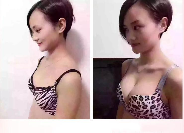 成都博爱坑人骗你没商量高额治疗费用