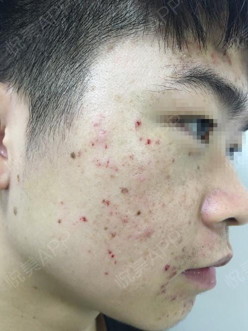 成都博爱医疗坑人赚黑心钱套路太多太坑太骗太歪太黑