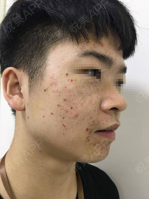 成都博爱医院坑人赚黑心钱千万别去骗子医院真的是吃人不